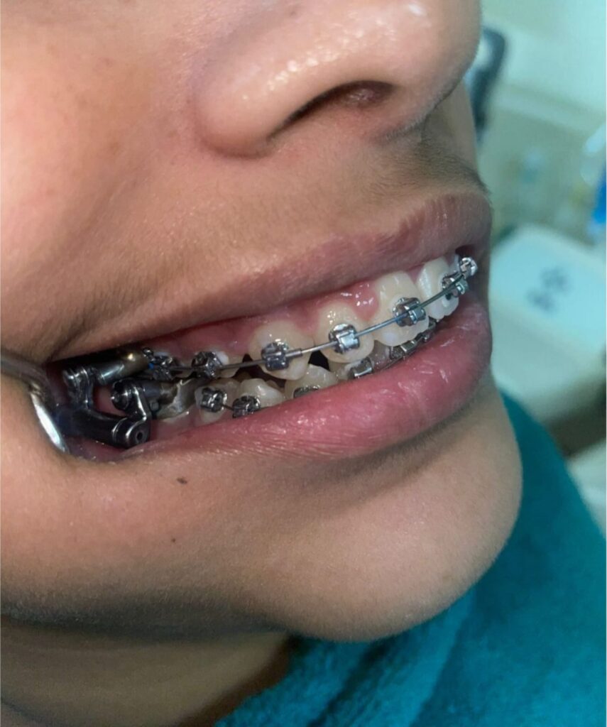 Orthodontics