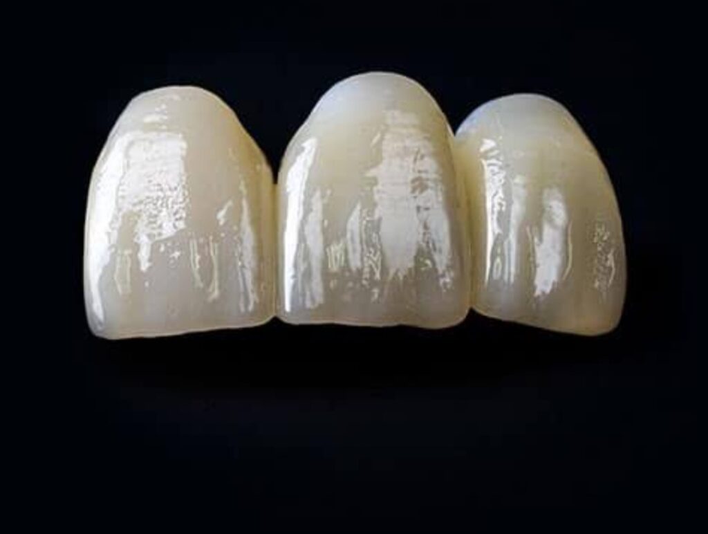 Prosthodontics