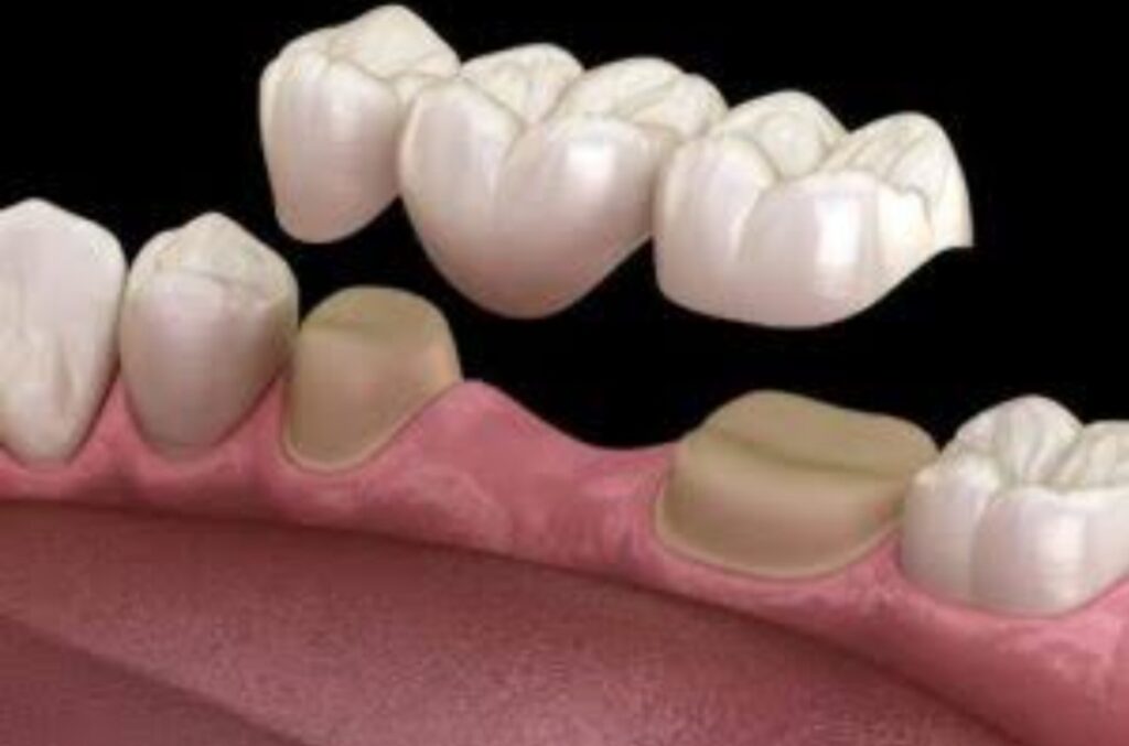 Prosthodontics