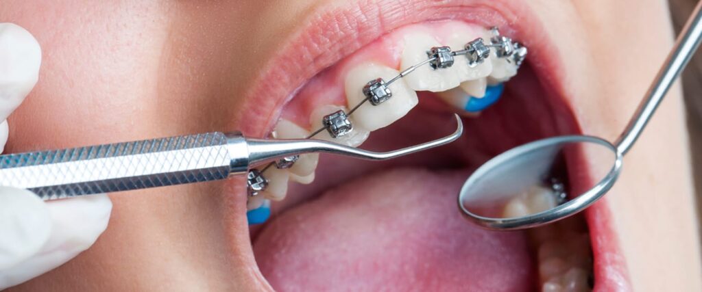 Orthodontics